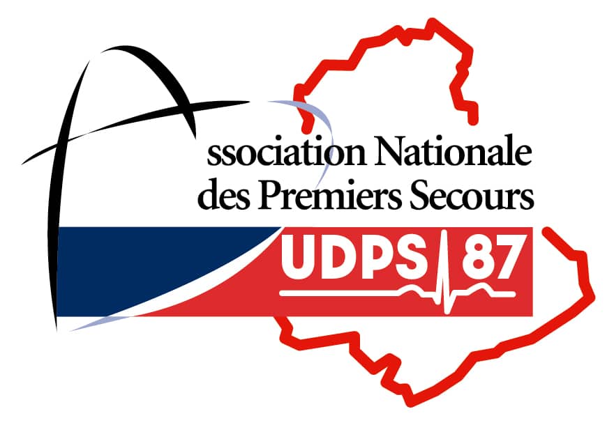 UDPS87